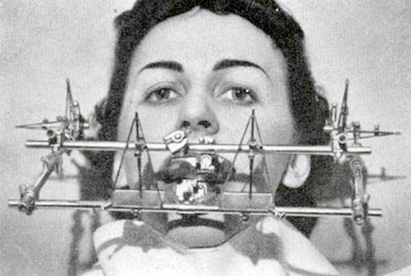 Scary Dental Equipment From Days Gone By (26 photos)