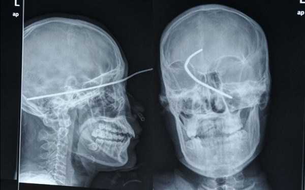 Unbelievably Bizarre X-Rays (25 photos)