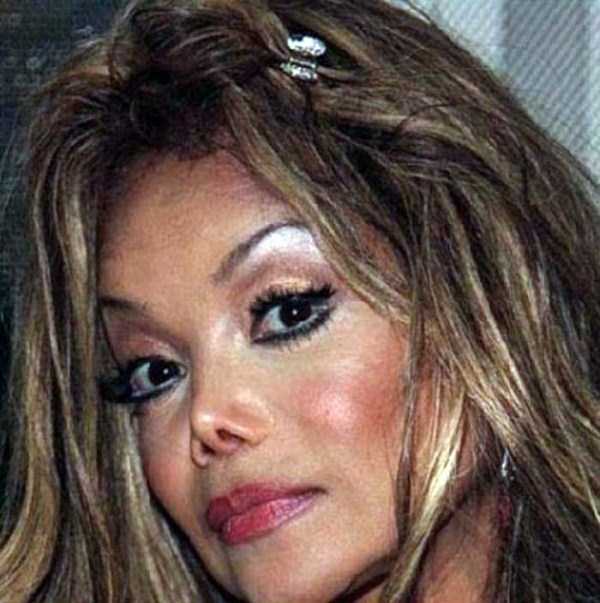 plastic surgery disasters 10