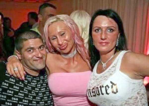 plastic surgery disasters 13