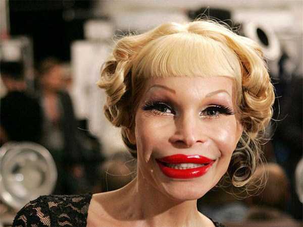 plastic surgery disasters 23