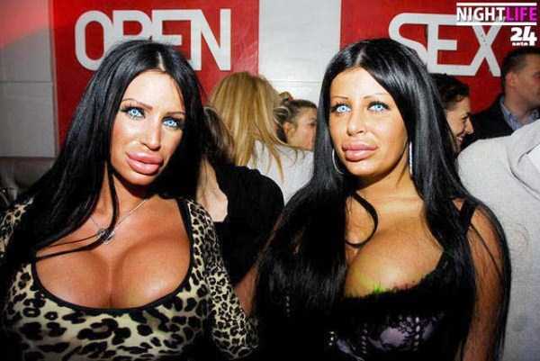 plastic surgery disasters 32