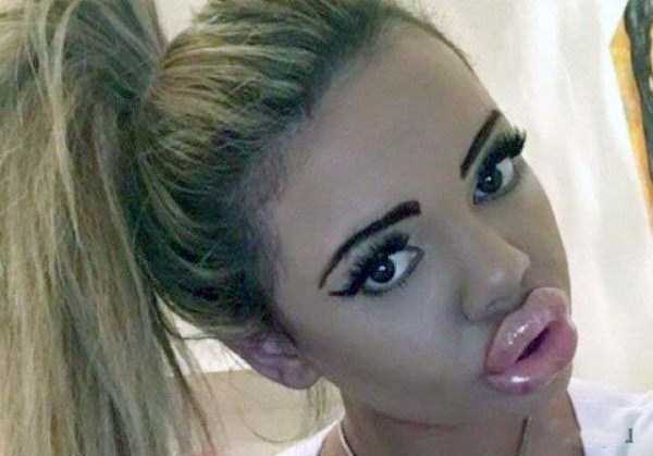 plastic surgery disasters 37