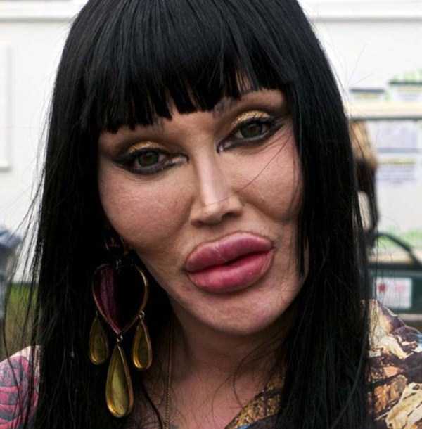 Plastic Surgery Freaks (39 photos)