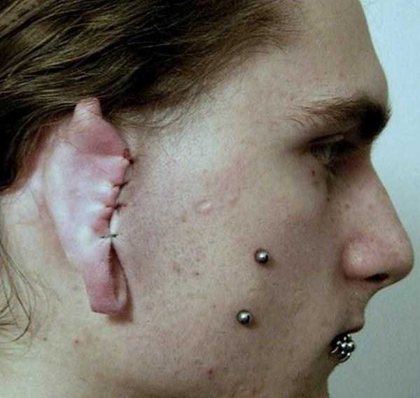 Scary Body Mods (30 photos)