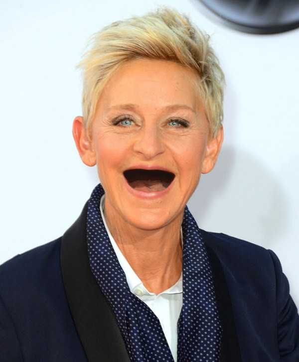 Famous People Without Teeth (20 photos)