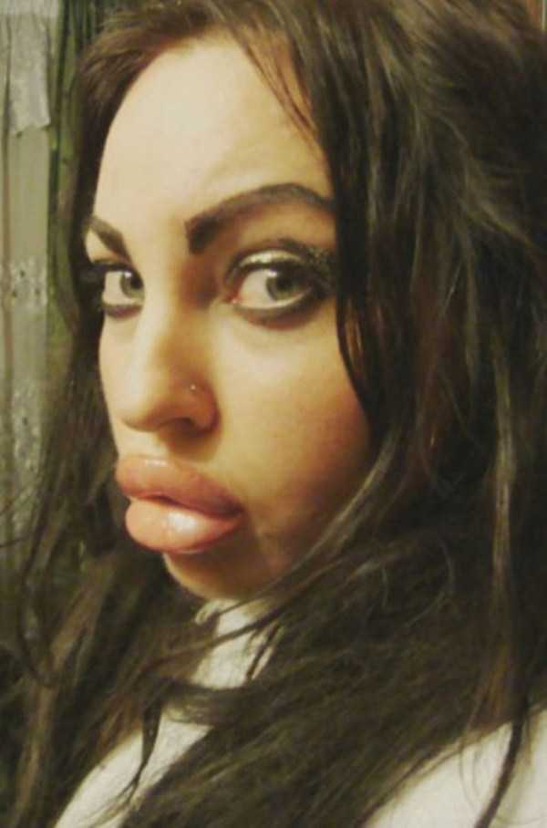 Girls With Ridiculously Huge Lips (52 photos)