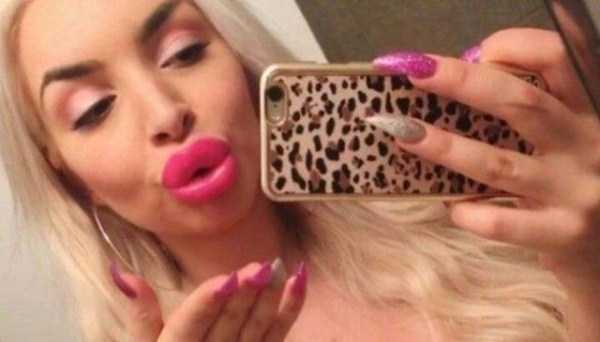 Over Inflated Lips Are A Bad Idea (30 photos)