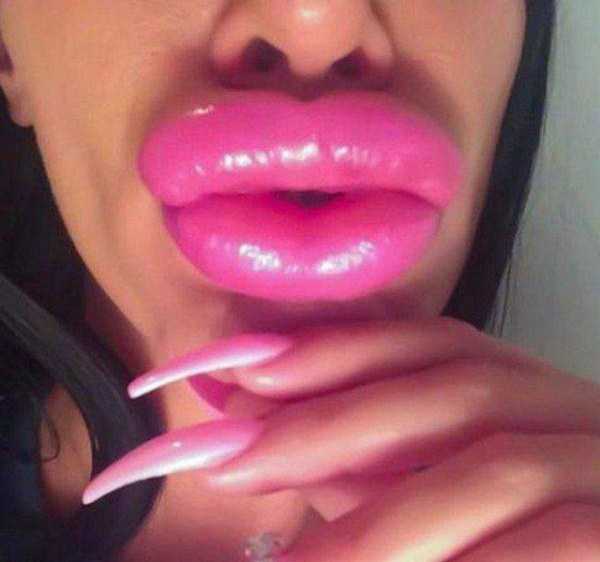 extreme lips 14