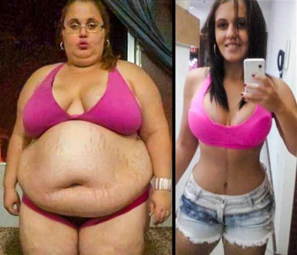 Amazing Weight Loss Journeys (72 photos)
