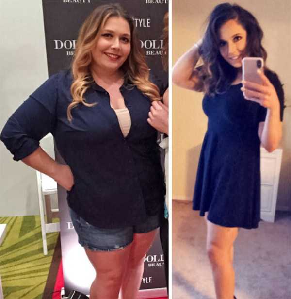 Amazing Weight Loss Journeys (72 photos)