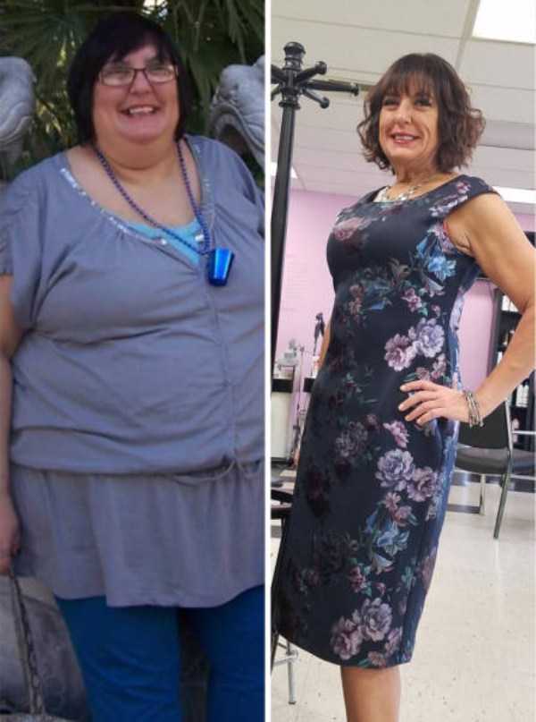 Amazing Weight Loss Journeys (72 photos)