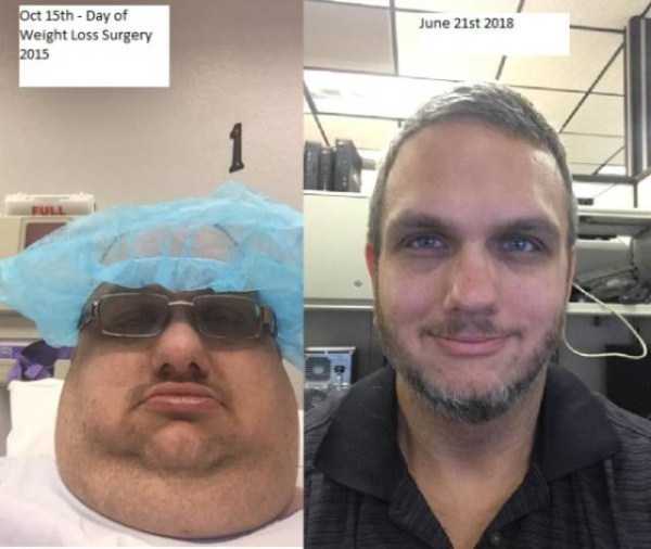Amazing Weight Loss Journeys (72 photos)
