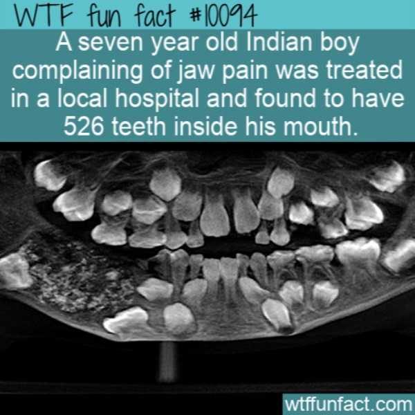 It’s Time For Some Cool And Interesting Facts – Part 122 (54 photos)