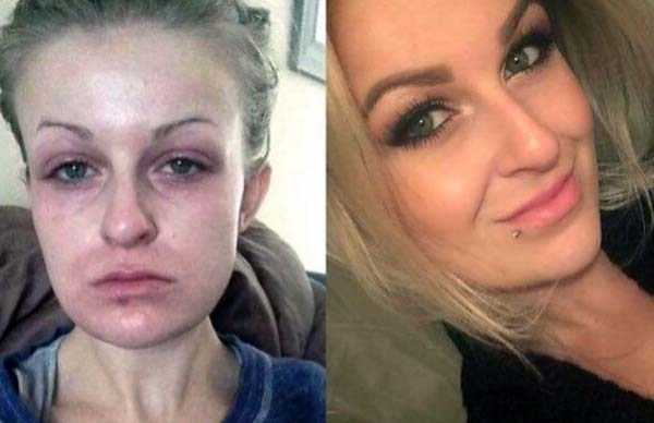During And After Drug Consumption (51 photos)