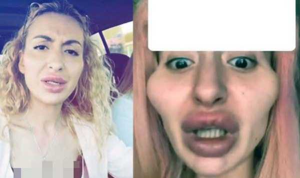 26 Plastic Surgery Catastrophes (26 photos)