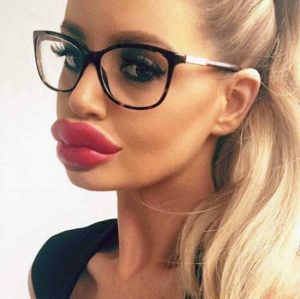 26 Plastic Surgery Catastrophes (26 photos)