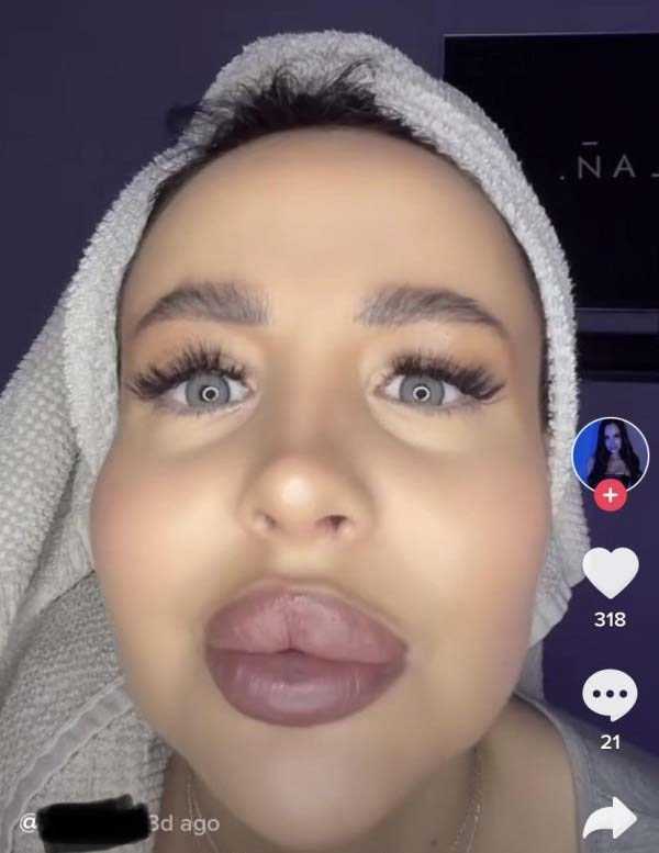 26 Plastic Surgery Catastrophes (26 photos)