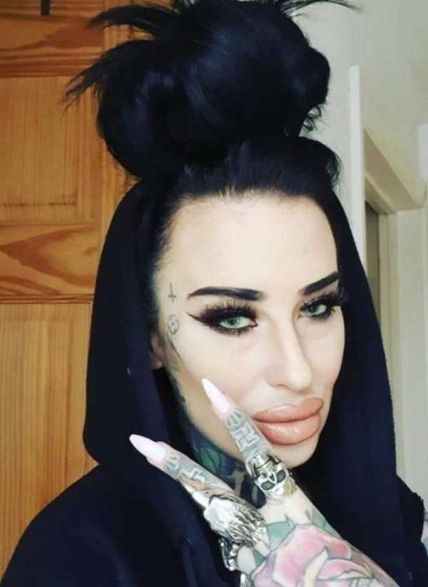 26 Plastic Surgery Catastrophes (26 photos)