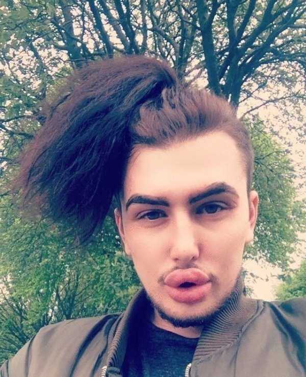 26 Plastic Surgery Catastrophes (26 photos)