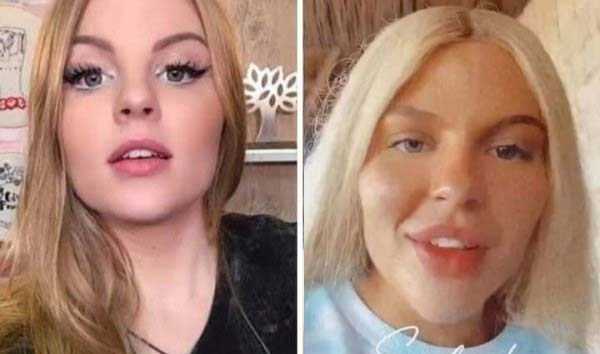 26 Plastic Surgery Catastrophes (26 photos)