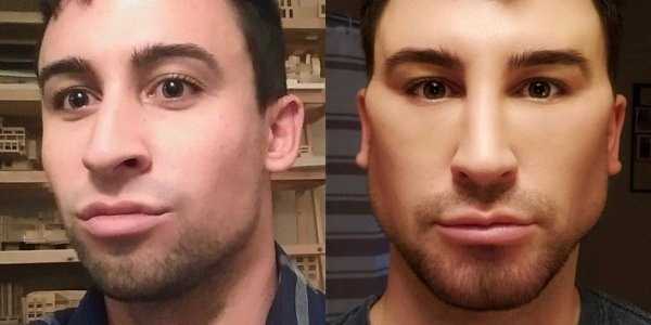 26 Plastic Surgery Catastrophes (26 photos)