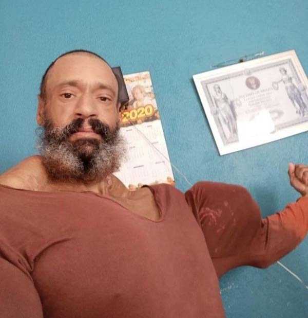 26 Plastic Surgery Catastrophes (26 photos)