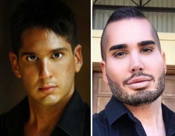 26 Plastic Surgery Catastrophes (26 photos)