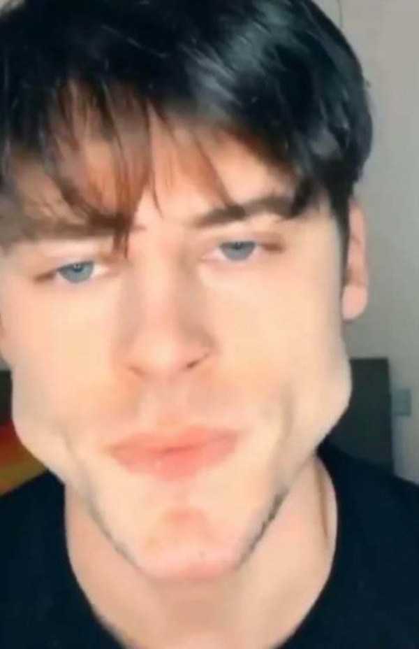 26 Plastic Surgery Catastrophes (26 photos)