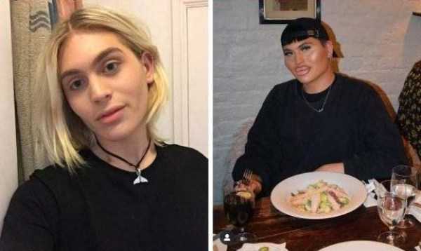 26 Plastic Surgery Catastrophes (26 photos)