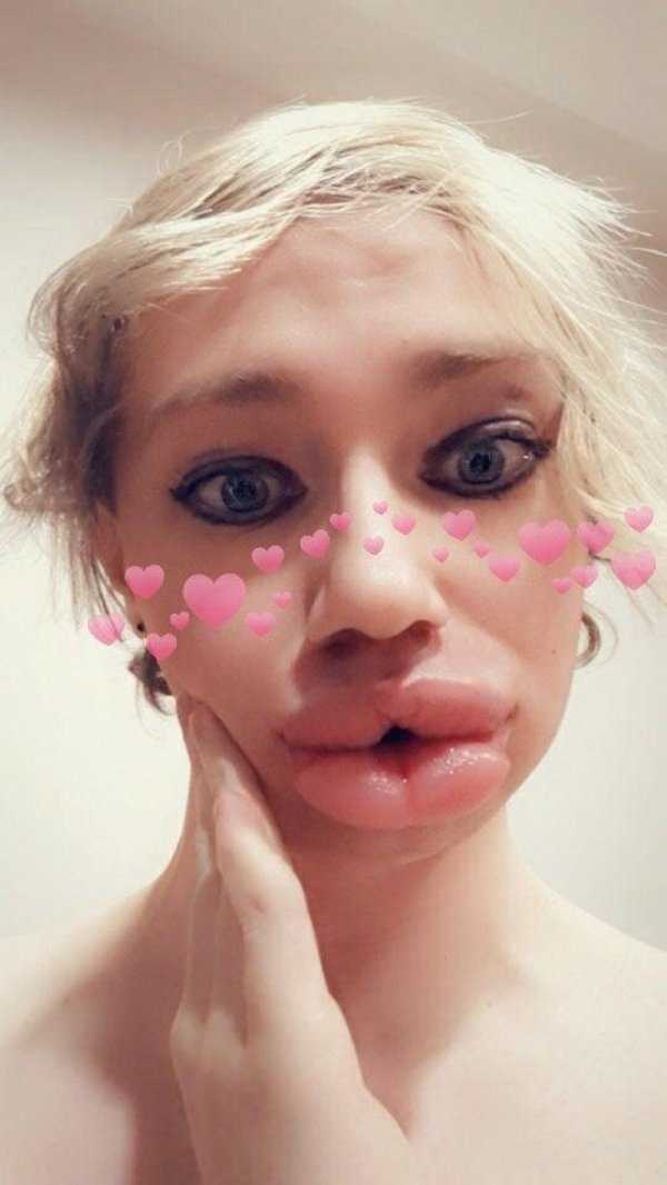 26 Plastic Surgery Catastrophes (26 photos)