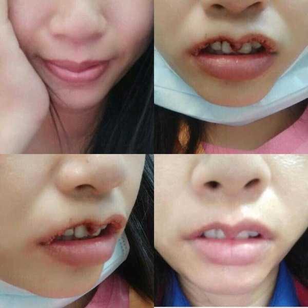 26 Plastic Surgery Catastrophes (26 photos)