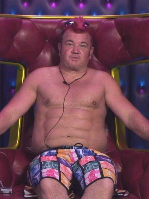 26 Plastic Surgery Catastrophes (26 photos)