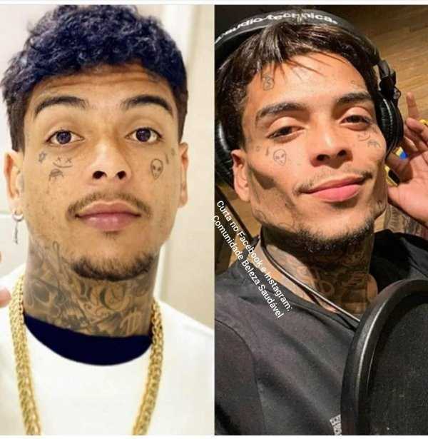 26 Plastic Surgery Catastrophes (26 photos)