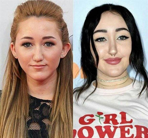 30 People Before And After Plastic Surgery (30 photos)