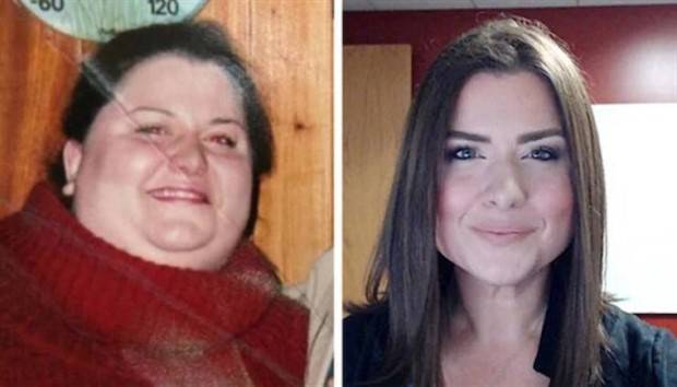Weight Loss Is Possible #3 (39 photos)