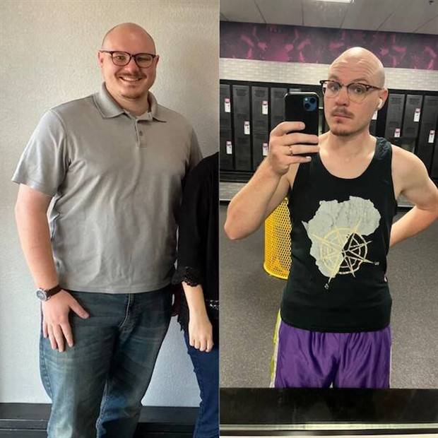 Weight Loss Is Possible #3 (39 photos)