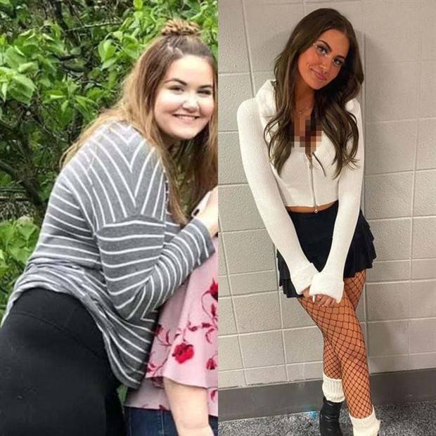 Weight Loss Is Possible #4 (38 photos)