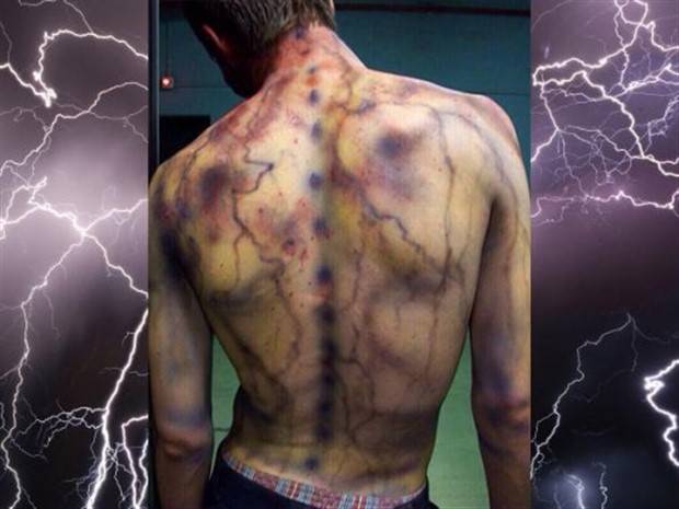 lightning strikes aftermath 24 When Lightning Strikes (24 photos)