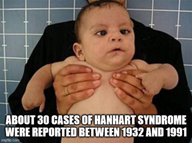It’s Time for Some Cool and Interesting Facts #341 (32 photos)