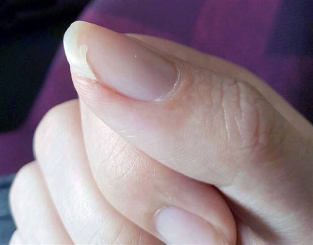 frustrating situations 5 23 Situations That Would Simply Drive You Nuts (23 photos)