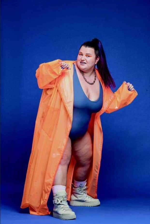 eurovision freaks 7 Eurovision, What Happened to You? (13 photos)