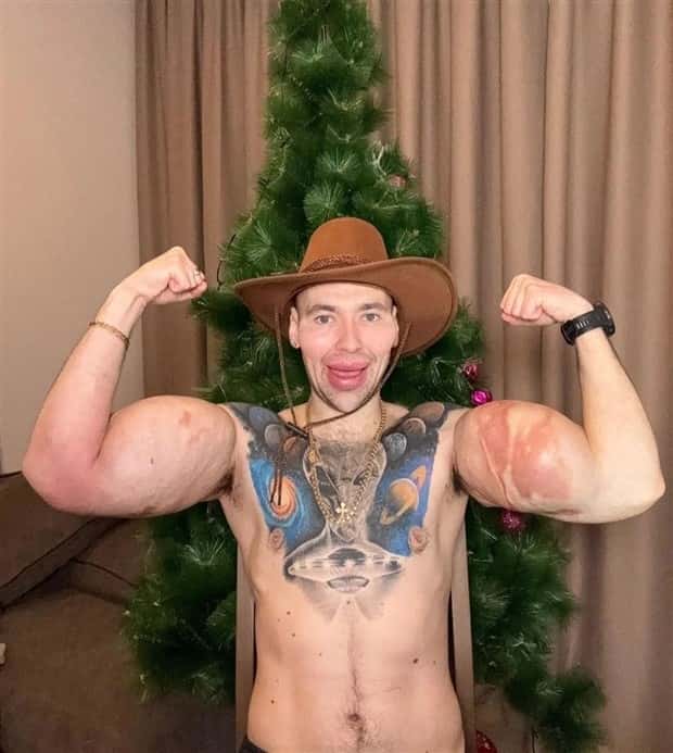 Unfortunate Cosmetic Enhancement Failures (31 photos)