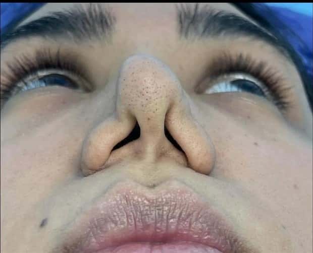 Unfortunate Cosmetic Enhancement Failures (31 photos)