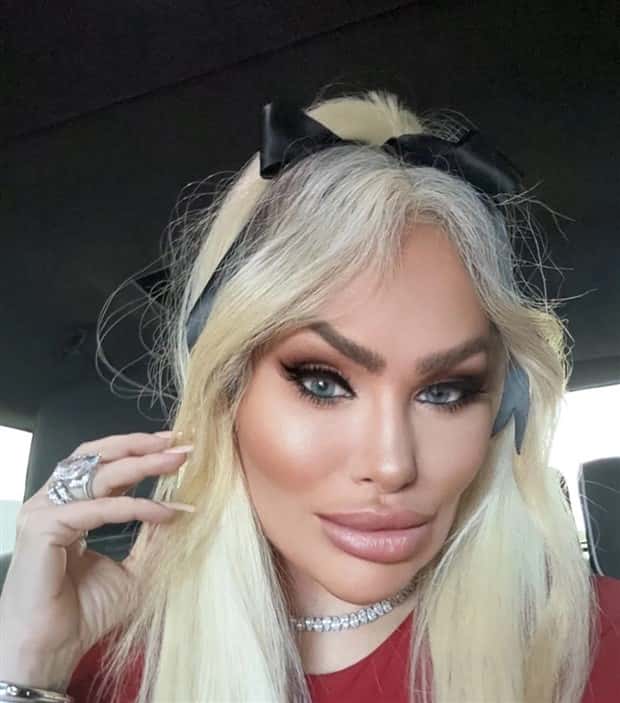 Unfortunate Cosmetic Enhancement Failures (31 photos)