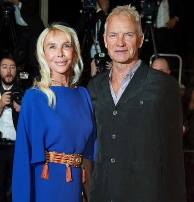 Unfortunate Cosmetic Enhancement Failures (31 photos)