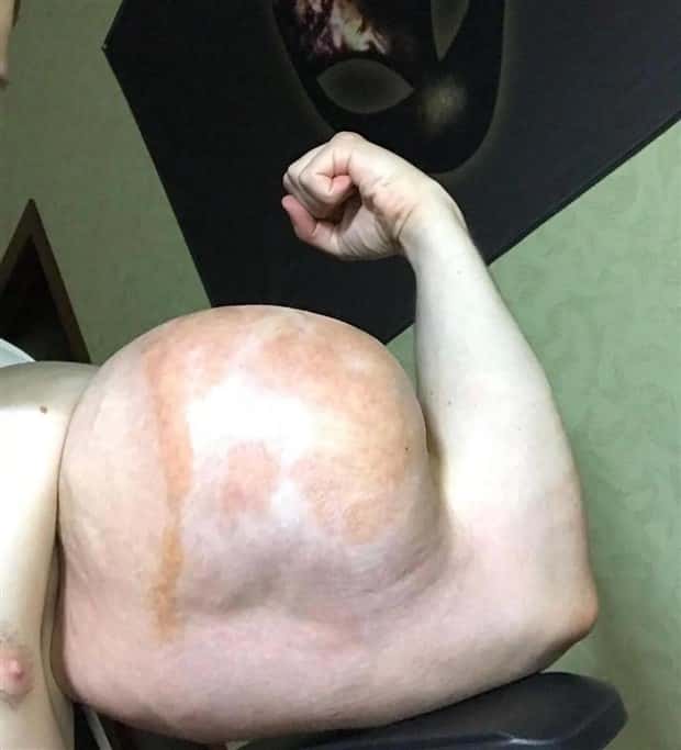 Unfortunate Cosmetic Enhancement Failures (31 photos)