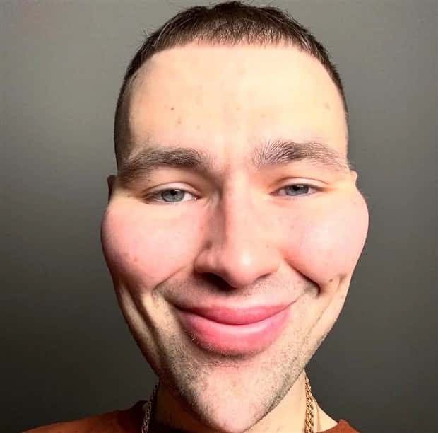 Unfortunate Cosmetic Enhancement Failures (31 photos)