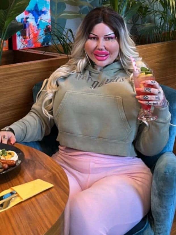 Unfortunate Cosmetic Enhancement Failures (31 photos)