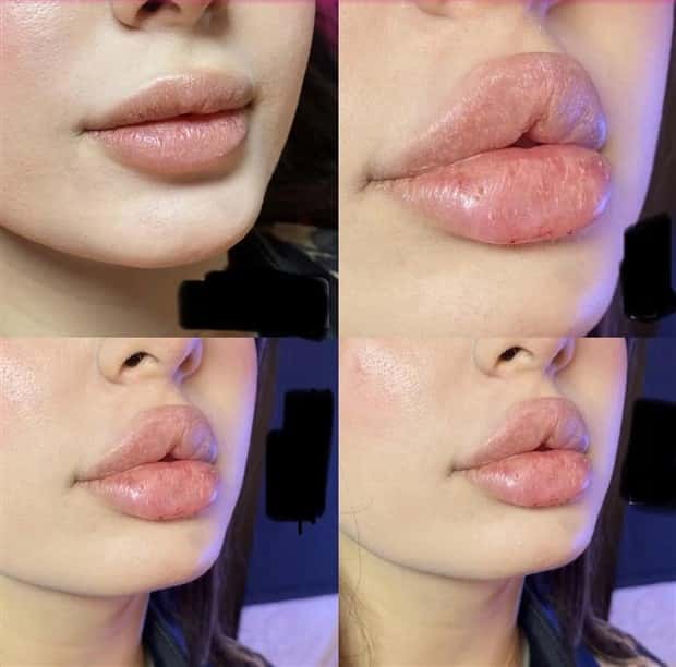 Unfortunate Cosmetic Enhancement Failures (31 photos)